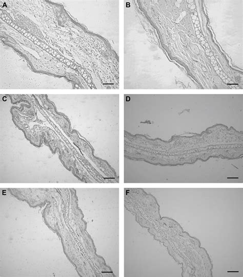 Photomicrographs Of Histological Sections Of The Mouse Ears ×10