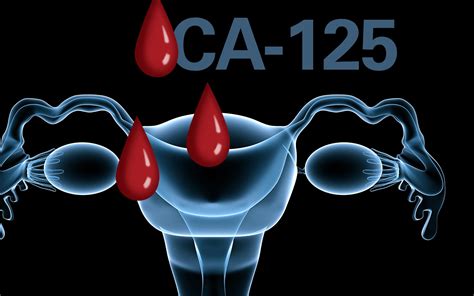 Tumor Marker Ca 125 Women Health Info Blog