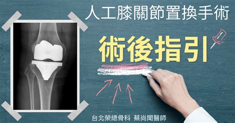 人工膝關節置換手術術後指引：手術後您該知道的這些事？｜蔡尚聞醫師