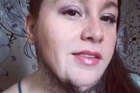 Bearded Woman Tired Of Shaving Embraces Facial Hair And Plaits It For