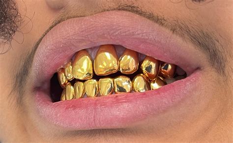 NPG / Dental Gold - Gold Teeth Master