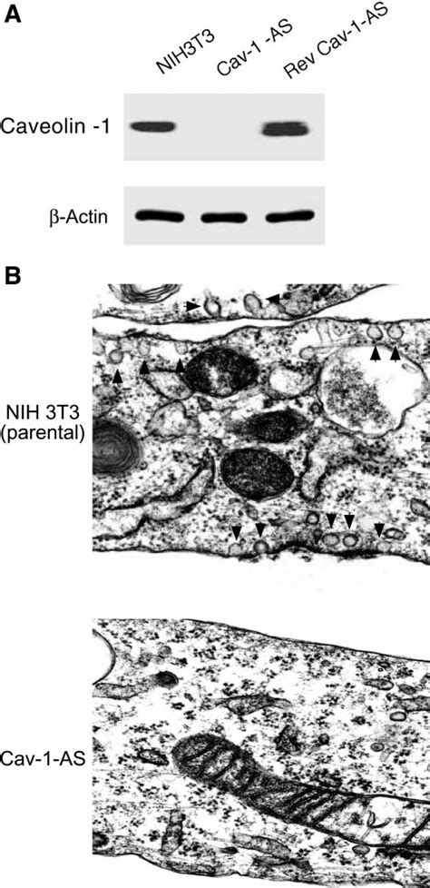 Downregulation Of Caveolin 1 Expression And Caveolae Organelles In