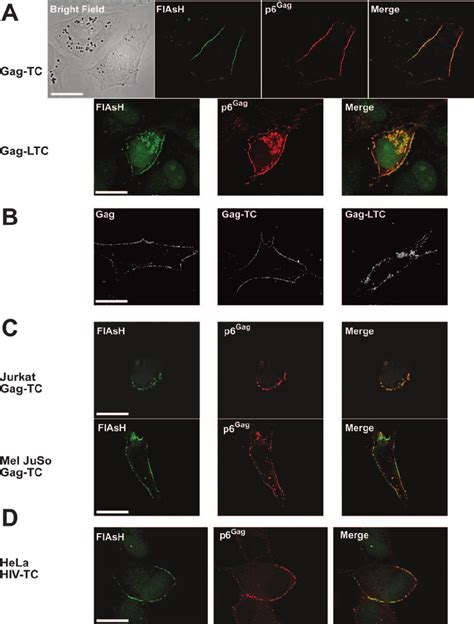 Gag Tc Labeling Fluorescence Micrographs Of Cells Expressing Various