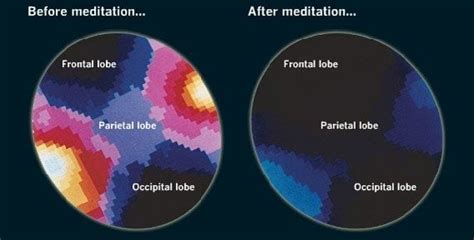 What is Meditation & How Does It Affects Our Brains? | Buffer