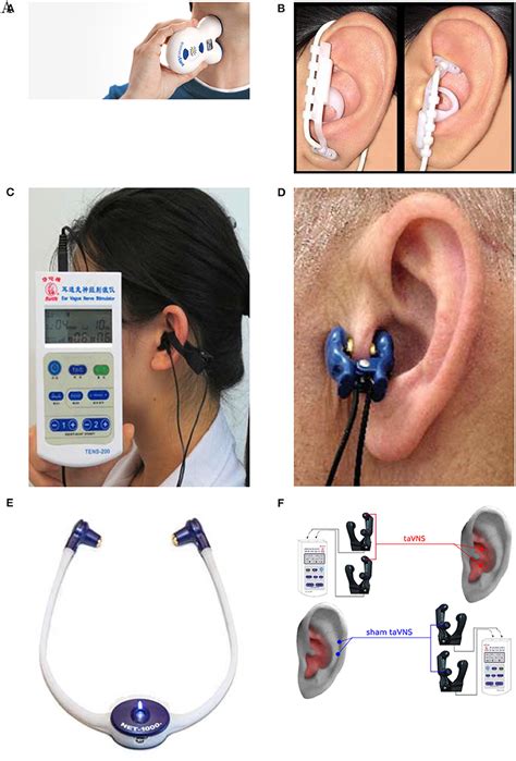 Best Vagus Nerve Stimulation Device Uk | wordpress-331561-1541677.cloudwaysapps.com