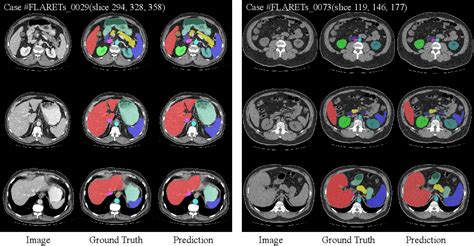 Figure From Teacher Student Semi Supervised Strategy For Abdominal Ct