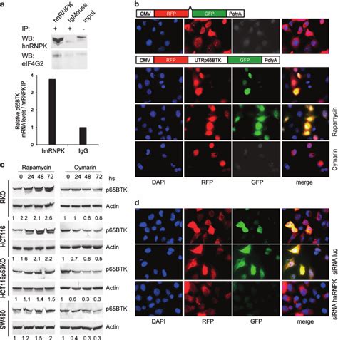 Hnrnpk Post Transcriptionally Regulates P Btk Expression Via