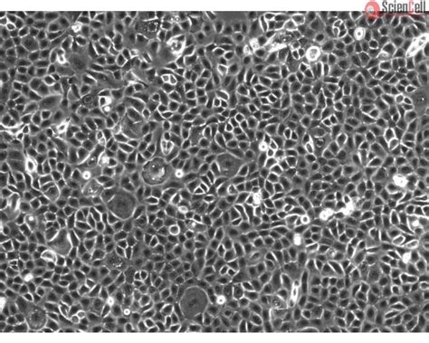 Human Small Airway Epithelial Cells Adult Hpsaepic A