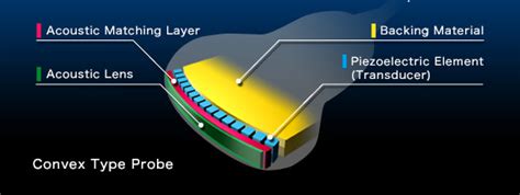 Ultrasound Probe Details｜ultrasound Probe Transducer ｜products｜ndk Nihon Dempa Kogyo Co Ltd