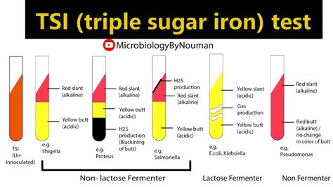 The Triple Sugar Iron Lab The Triple Sugar Iron TSI Test 51 OFF