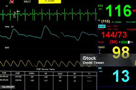 환자 모니터는 활력 징후 Ecg 심전도 Ekg 산소 포화도 Spo2 및 호흡을 표시합니다 감지기에 대한 스톡 사진 및 기타