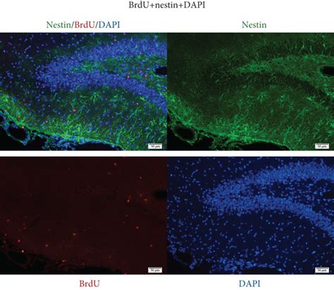 If In The Dg Of The Tbi Group Mouse Brain Got From Days Posttrauma