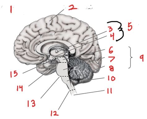 Neuro Unit Pictures Flashcards Quizlet