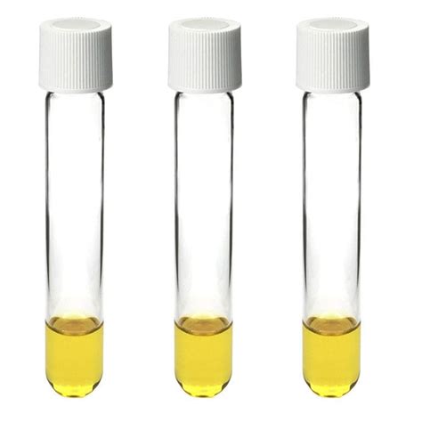 Laboratory Test Tube Cod Zhejiang Aijiren Technology Inc Round