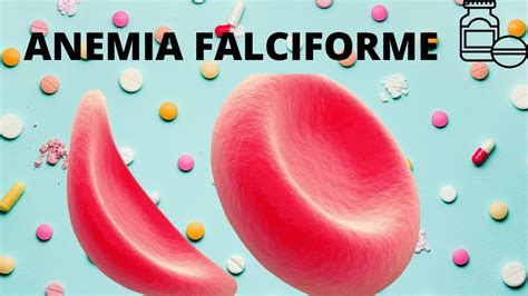 Anemia Falciforme YouTube