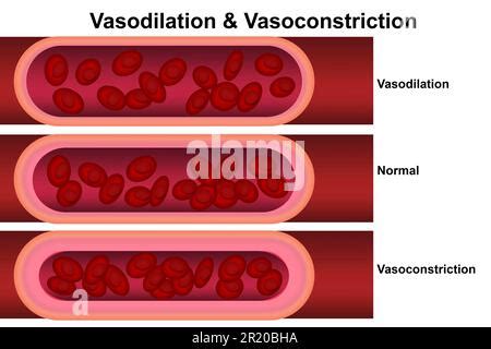 vasoconstriction and vasodilation blood pressure, dilated blood vessels ...