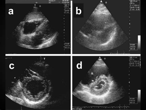 Focused Cardiac Ultrasound Focus Sonosif By Sifsof California