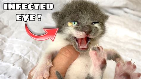 Rescued Baby Kitten Finally Opens Her Eyes Youtube