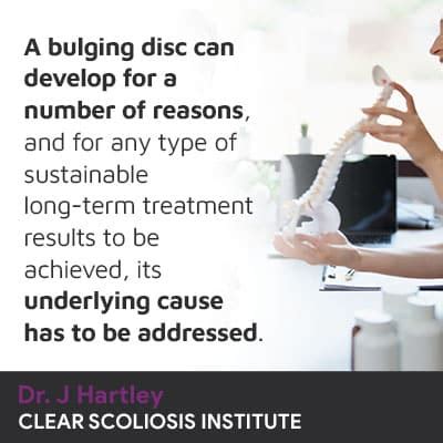 Treatment For Bulging Disc: Learn About Bulging Disc Treatment