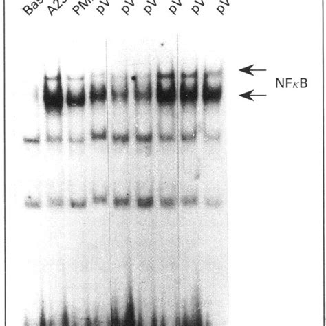 Pervanadate Induction Of Nf Cb Dna Binding Activity In Jurkat T Cells