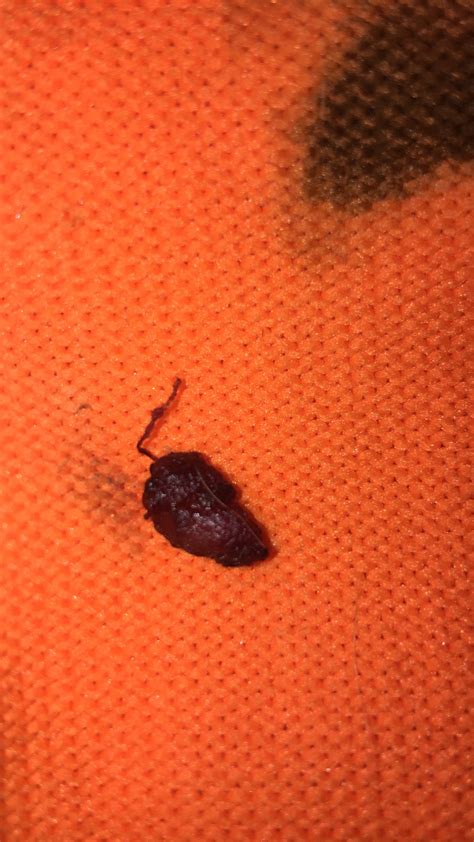 what does the blood of a miscarriage look like 11