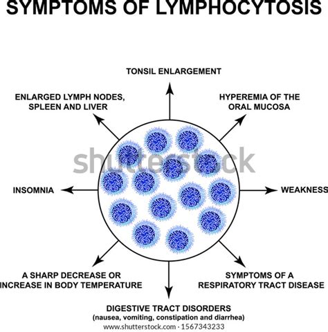 Symptoms Lymphocytosis Increase Lymphocytes Blood Cell Stock Vector ...