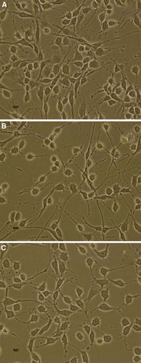 Effects Of Fs On Pc Cell Injury Induced By Ab A Control