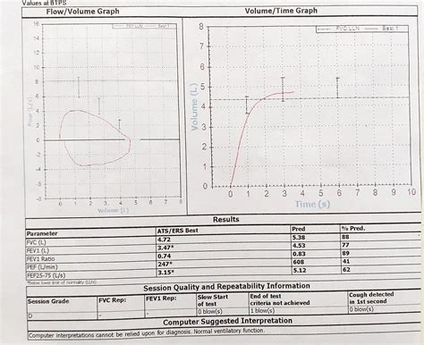 Help with spirometry test result : r/Asthma