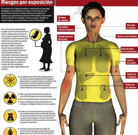 Bioética Cotidiana Los peligros de la radiación están en no informarse