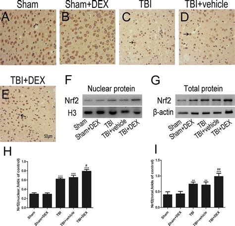 Dex Promotes Translocation Of Nrf From The Cytoplasm To The Nucleus