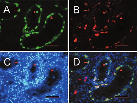 Immunofluorescent Staining Of Testis Sections A Expression Of Uchl1