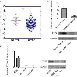 Effects of exogenous TNF α on the expression of the PTX3 in gastric