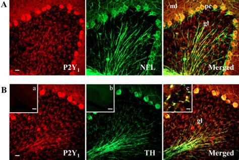 Localization Of P2Y1 Receptor On Neurons Confocal Images Demonstrate