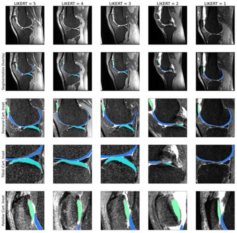 Bioengineering Special Issue Ai In Mri Frontiers And Applications