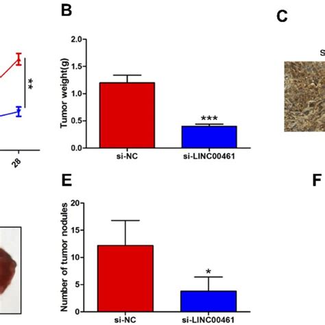 Mir 323b 3p Inhibits CRC Progression By Targeting NFIB A The Binding