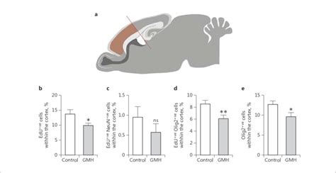 Germinal Matrix Haemorrhage Gmh At P0 Impacts Early Cortical