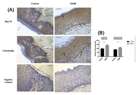 A Immunohistochemical Protein Expression Of Hsp 70 And Calreticulin In Download Scientific