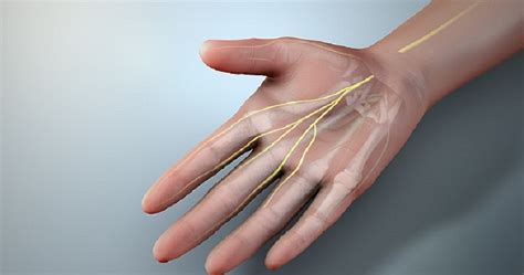 Median Nerve Injury Hand