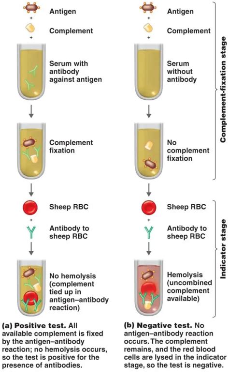 Complement Fixation Test Principle Types Procedure Results