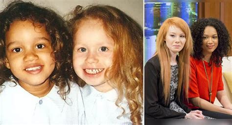 Lucy And Maria The Biracial Twin Sisters With Rare Black And White Skin