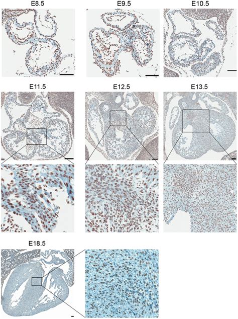 Wild Type Embryos At The Indicated Development Stages E To E