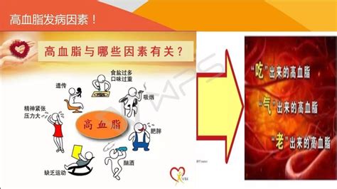 “血脂超高危”人群有你吗？最新血脂管理指南重磅发布！ 知乎