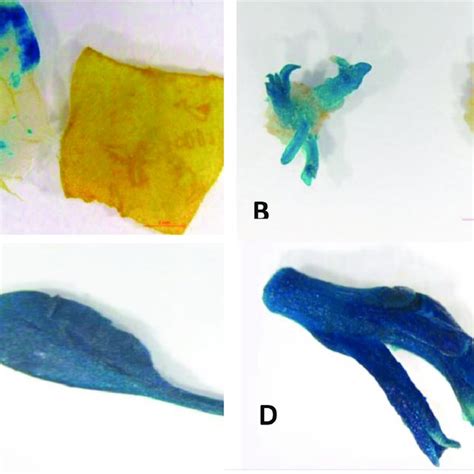 Different Steps Of Genetic Transformation Of Tobacco Infection With