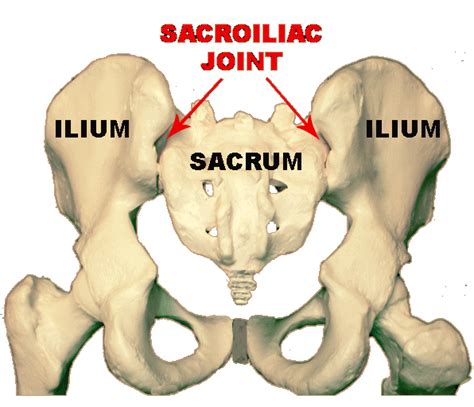 Pain Sensation: Sacrum Pain