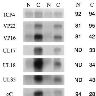 Protein Synthesis In Cells Infected With HSV Vero Cells Were Either