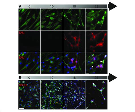 | Timeline of fibroblast marker expression during reprogramming. (A ...