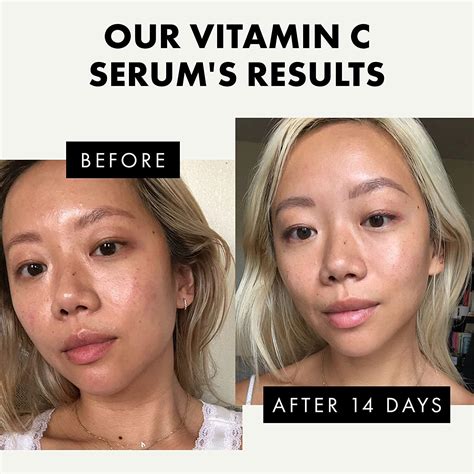 Vitamin C Serum For Faceneckeyes 5x More Powerful Anti Aging Serum