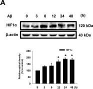 HIF 1 Alpha Antibody H1alpha67 NB100 105 Novus Biologicals