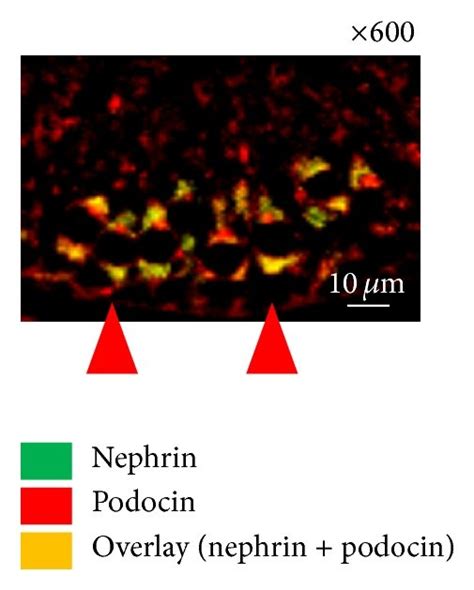 Immunofluorescence Double Staining For Nephrin And Podocin In The