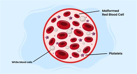 Alpha Thalassemia Exploring Genetics Hemoglobin Insights Medtigo